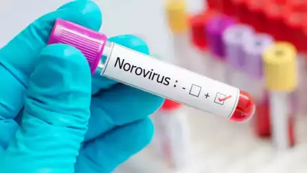 Norovirus Outbreaks: Understanding the Surge and Protecting Yourself